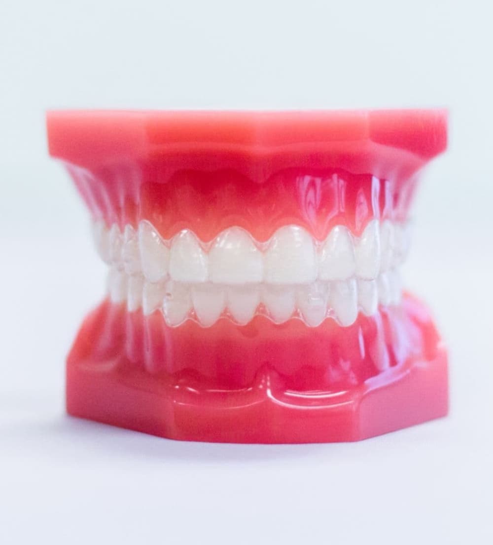 invisalign clear aligners on plastic model